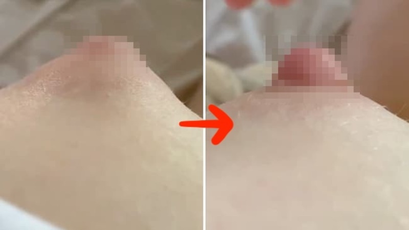 東欧の10代白人少女、陥没乳首を一瞬でぼ●きさせる方法がエ□すぎて1日に150万再生ｗｗｗ